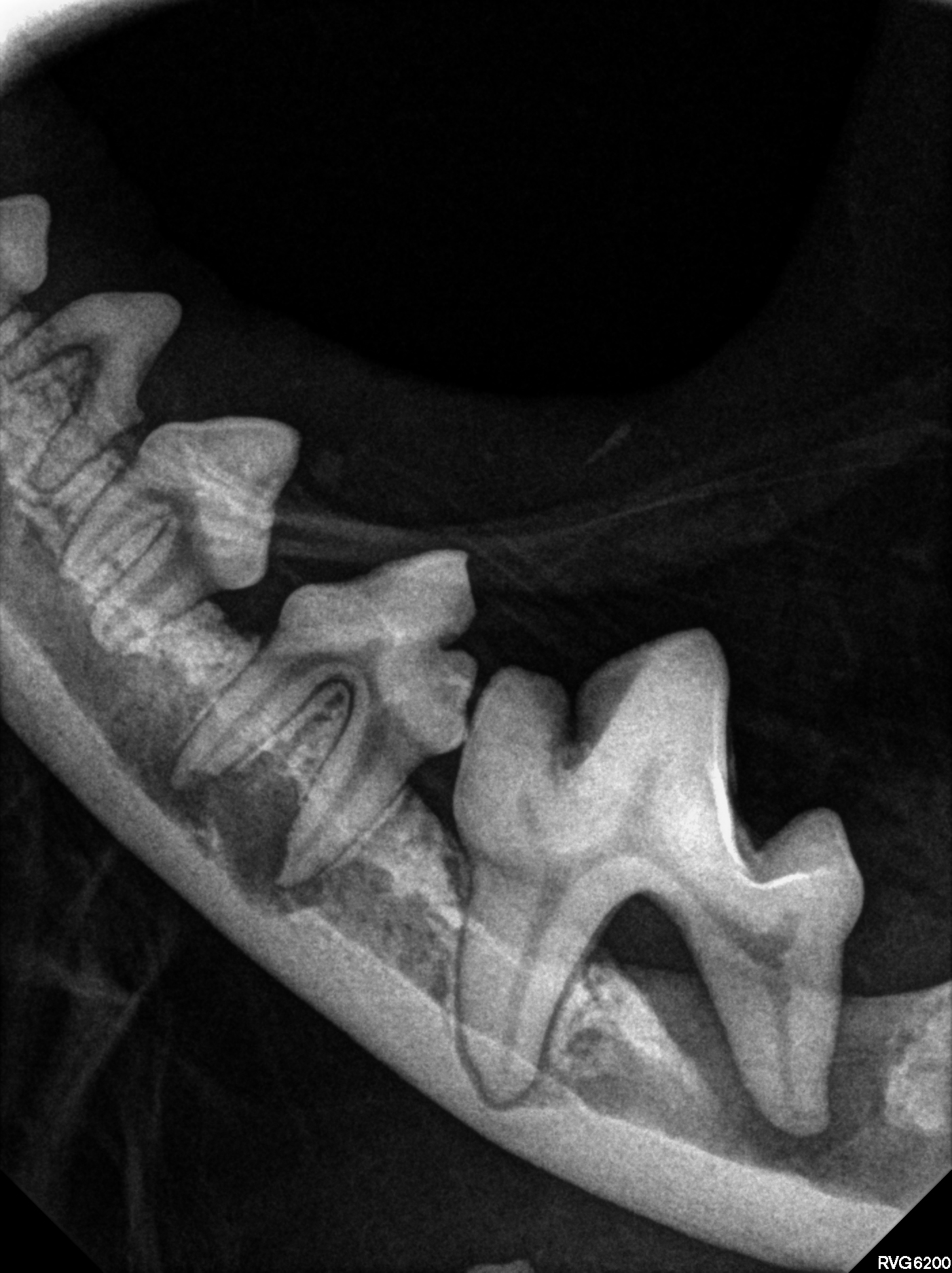 Zahnröntgen – Schweizer Röntgen